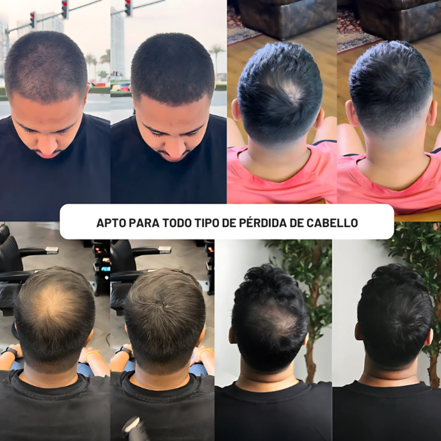 Polvo Rellenador Capilar